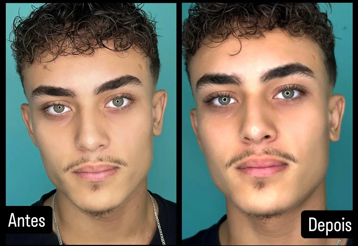 1º sessão antes e depois Luis