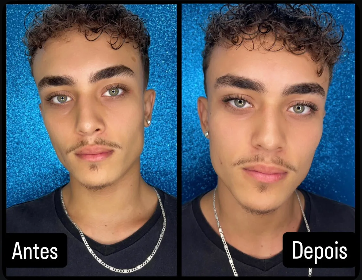 2º sessão antes e depois Luis
