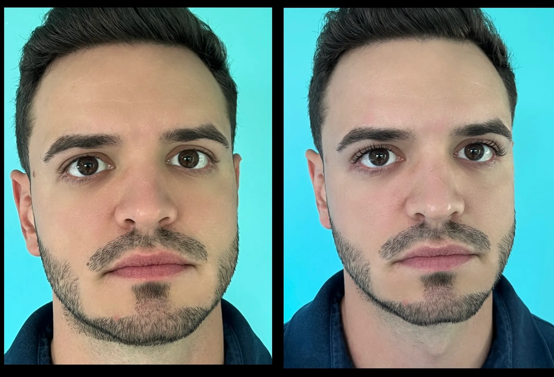 Eduardo antes e depois