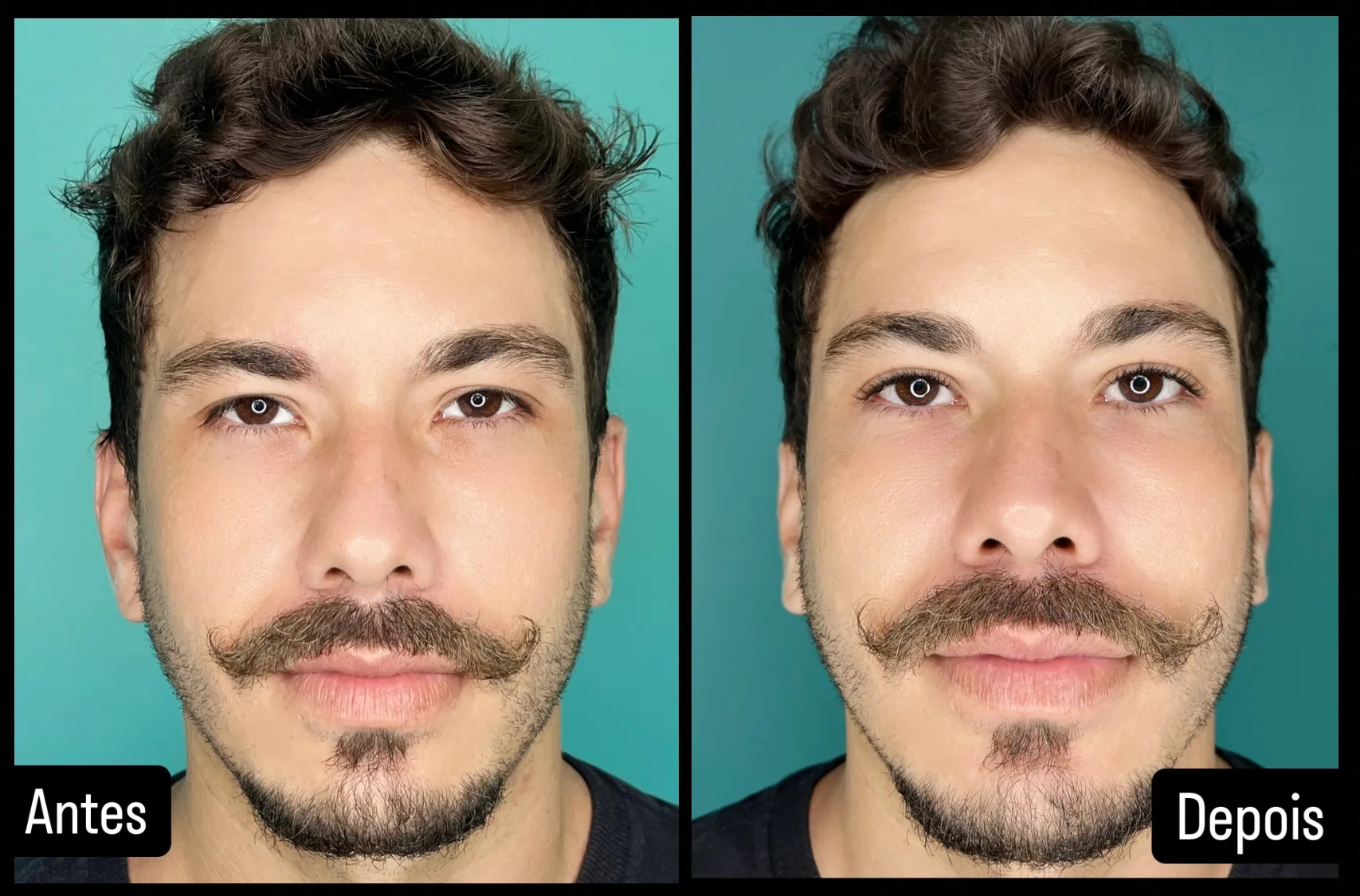 Ricardo antes e depois